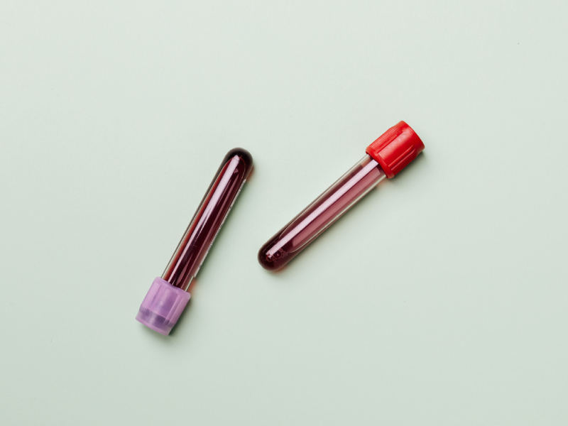phlebotomy-pre-analytical-services